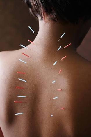 Acupuncturist / Alternative Medicine